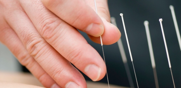 acupuntura ajuda no tratamento do cancer de mama - espaço kaizen